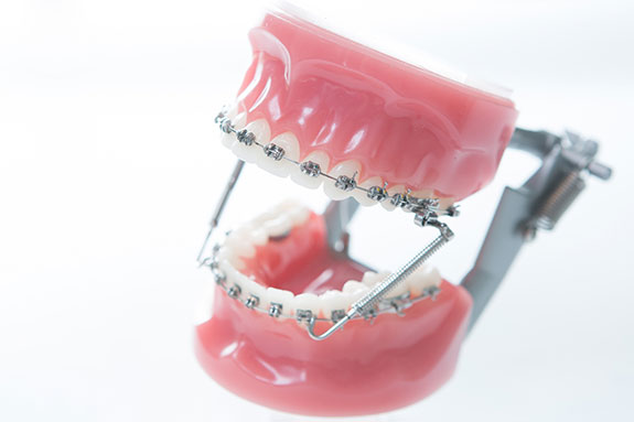 歯列矯正の目的とは？