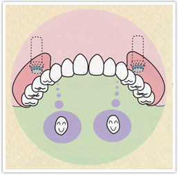 入れ歯とマグネットデンチャーの比較